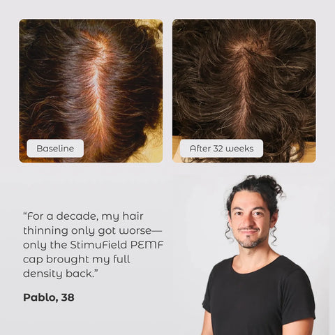 StimuField™ cap – Pre-Order